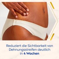 NIVEA LUMINOUS630® ANTI-DEHNUNGSSTREIFEN & PIGMENTFLECKEN Body Creme 200,0 ml