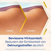 NIVEA LUMINOUS630® ANTI-DEHNUNGSSTREIFEN Pflege- und Massageöl 100,0 ml