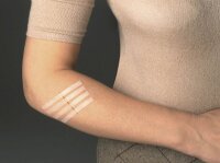 Nexcare™ Klammerpflaster Steri-Strip R150C weiß, 8 St.